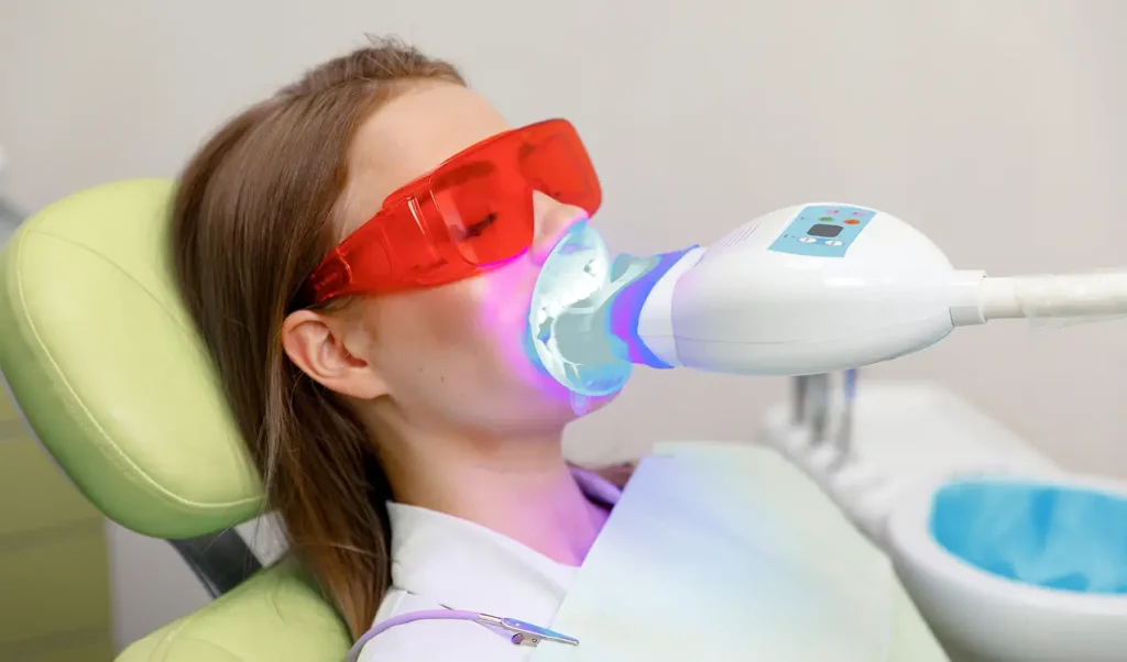 Experience Teeth Whitening with The Smile Artisans