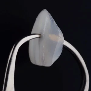 Porcelain Veneers Procedure shell